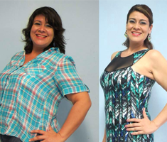 Slider image (2) Bypass Gastrico Merida